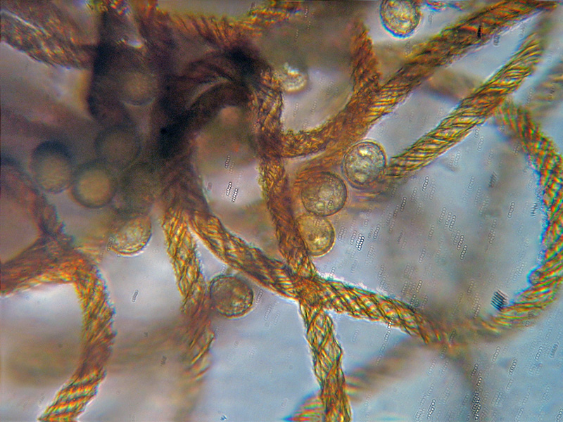 Ma non spariscono mai ?